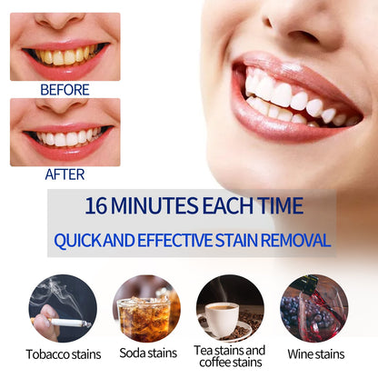 Smart Teeth Whitening Kit