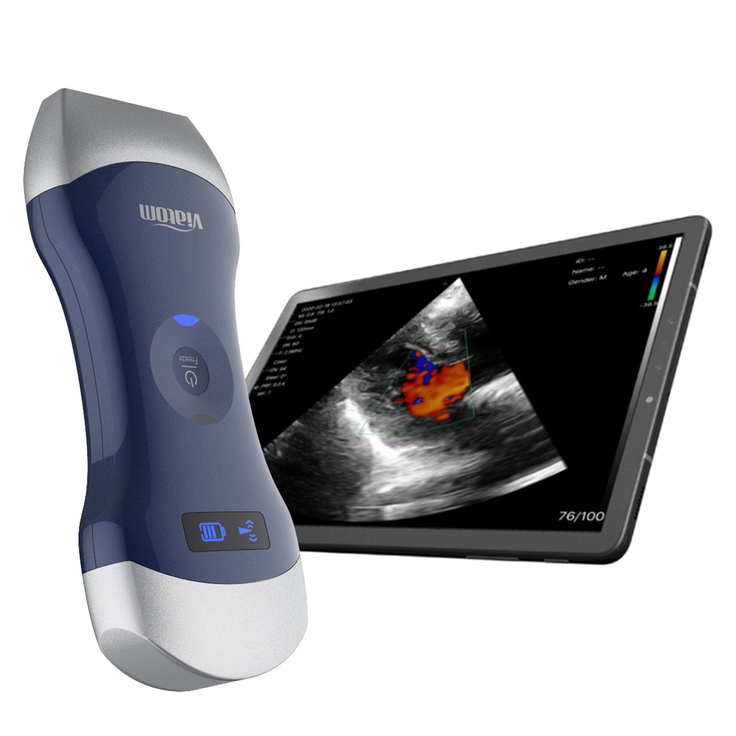 The Viatom Mini Portable Ultrasound