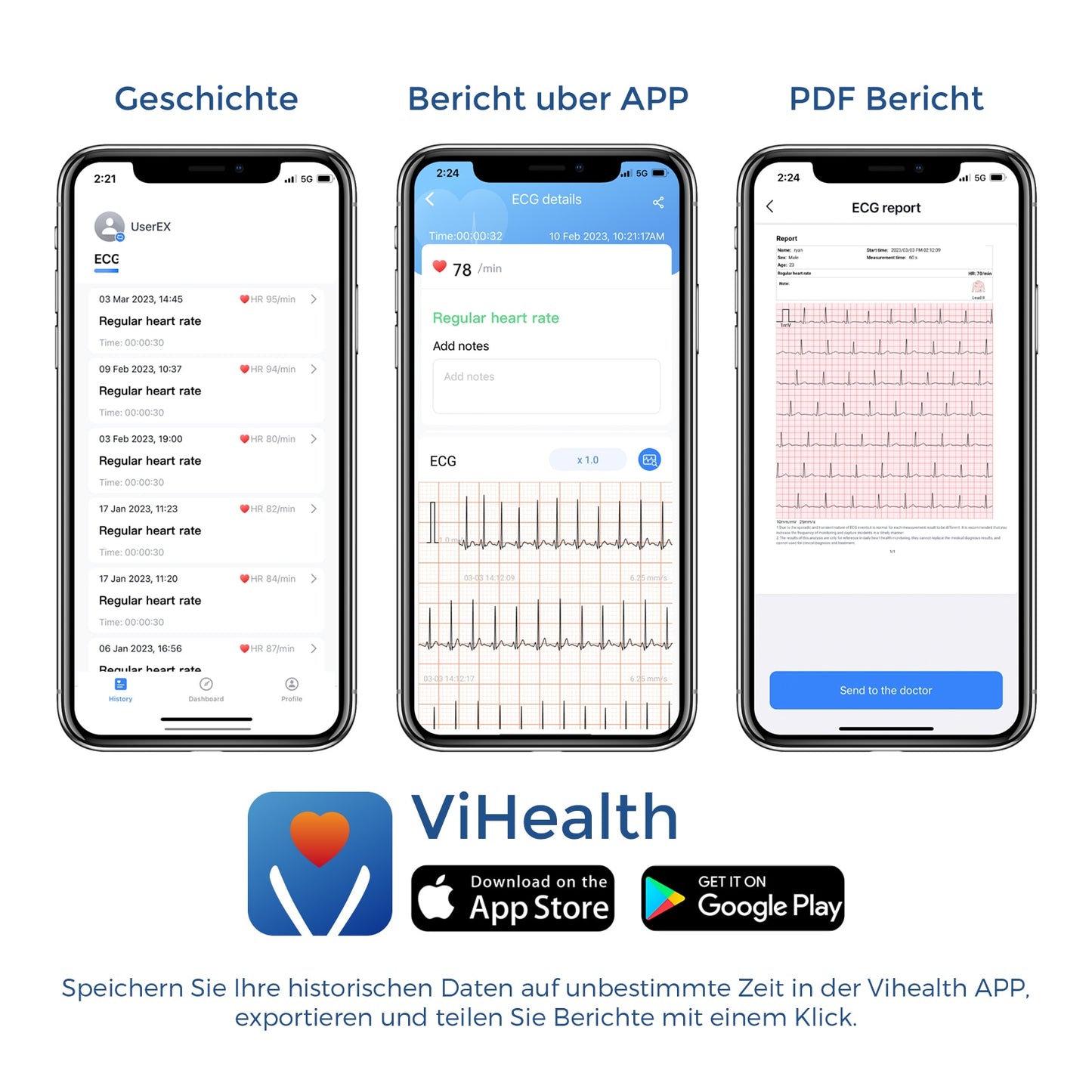 Pulsebit EX ECG/EKG Heart Monitor