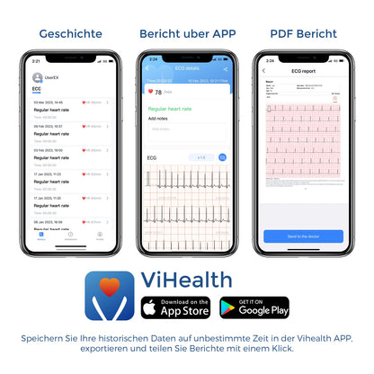 Pulsebit EX ECG/EKG Heart Monitor