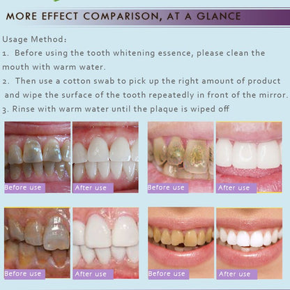 Teeth Whitening Essence