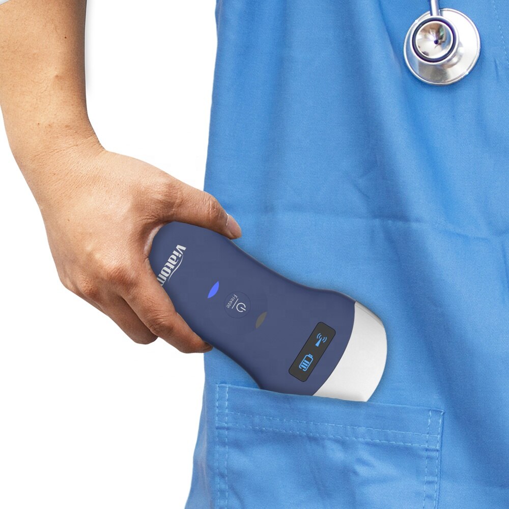 The Viatom Mini Portable Ultrasound