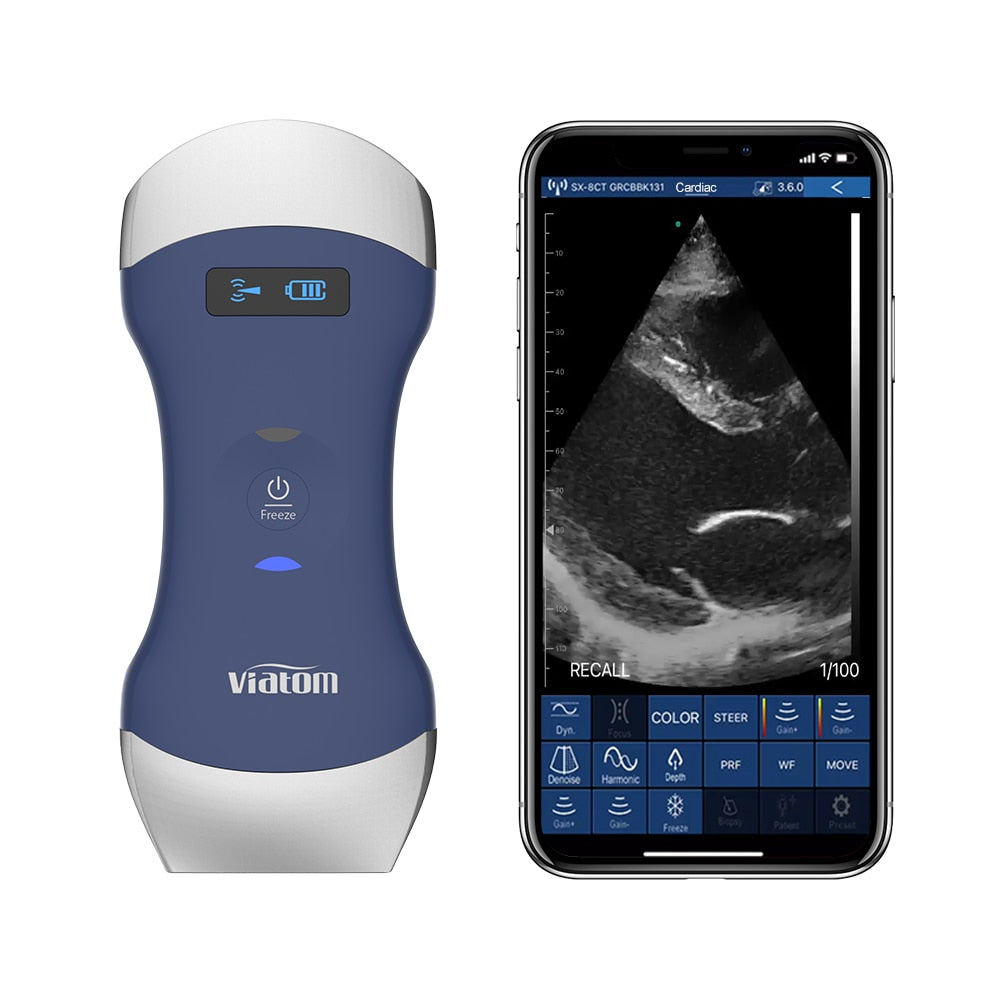 The Viatom Mini Portable Ultrasound