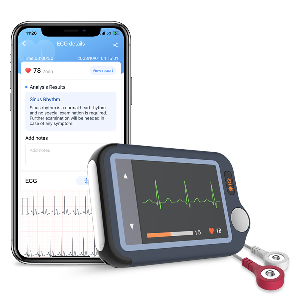 Pulsebit EX ECG/EKG Heart Monitor