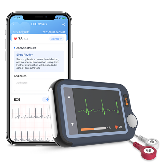 Pulsebit EX ECG/EKG Heart Monitor